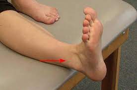 Ankle Sprain