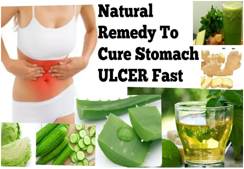 Stomach Ulcer