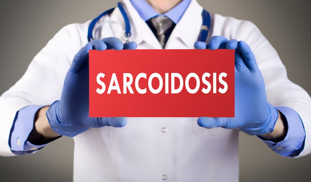 sarcoidosis